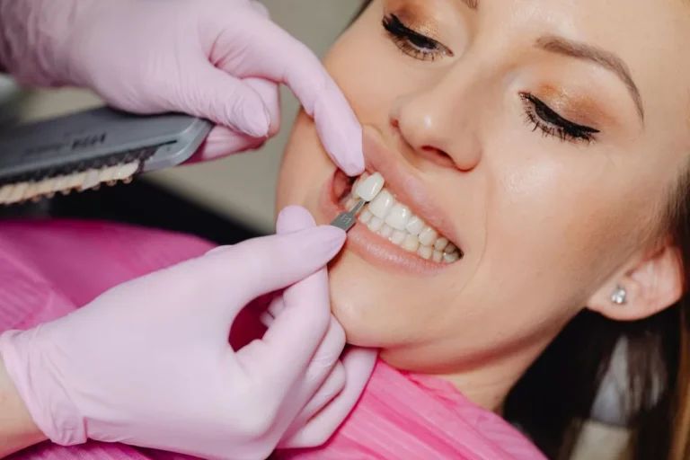 Aesthetic Dentistry Teeth Whitening