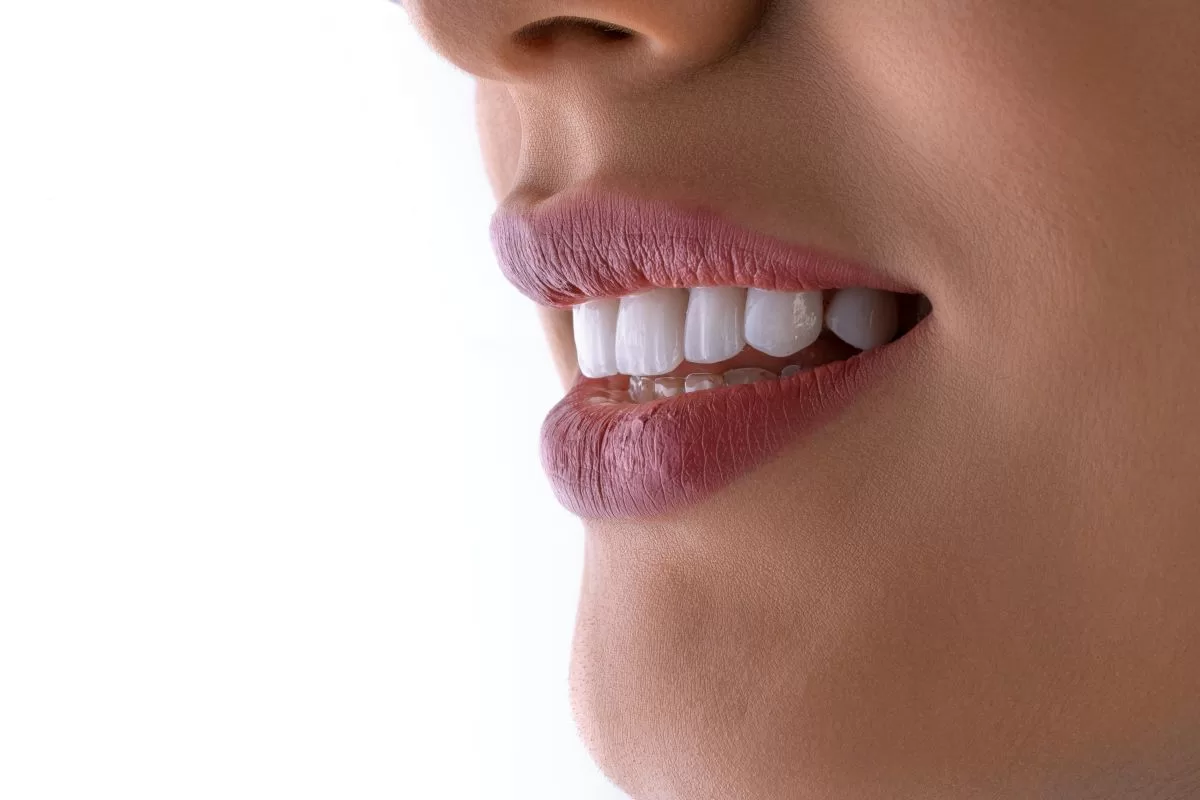 Impacted Teeth Istanbul Turkey Genc Dental 2 Jpg