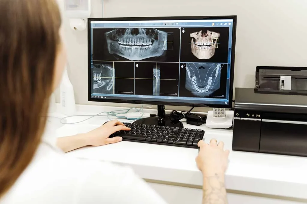 Dental Implants Turkey Cost