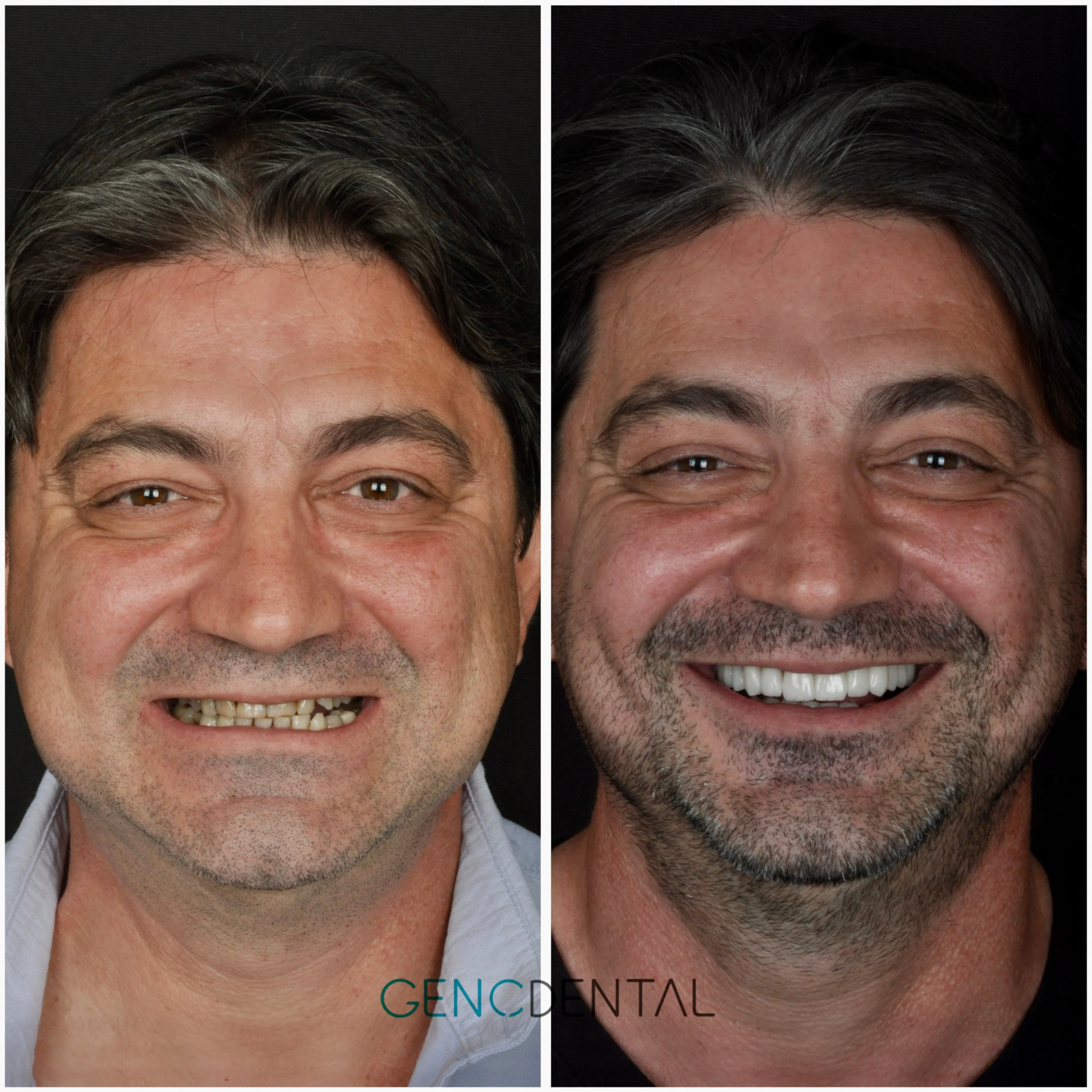 Treatment Result