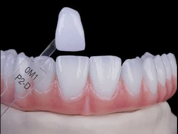 Ataşehir Zirkonyum Kaplama Diş Fiyatları 