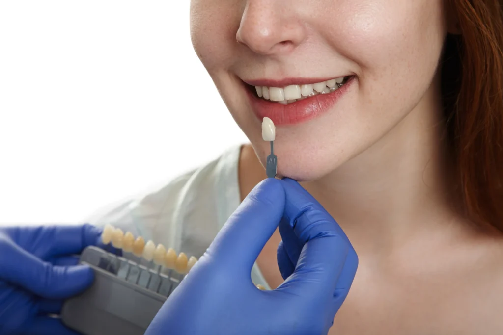 Veneers Turkey Cost