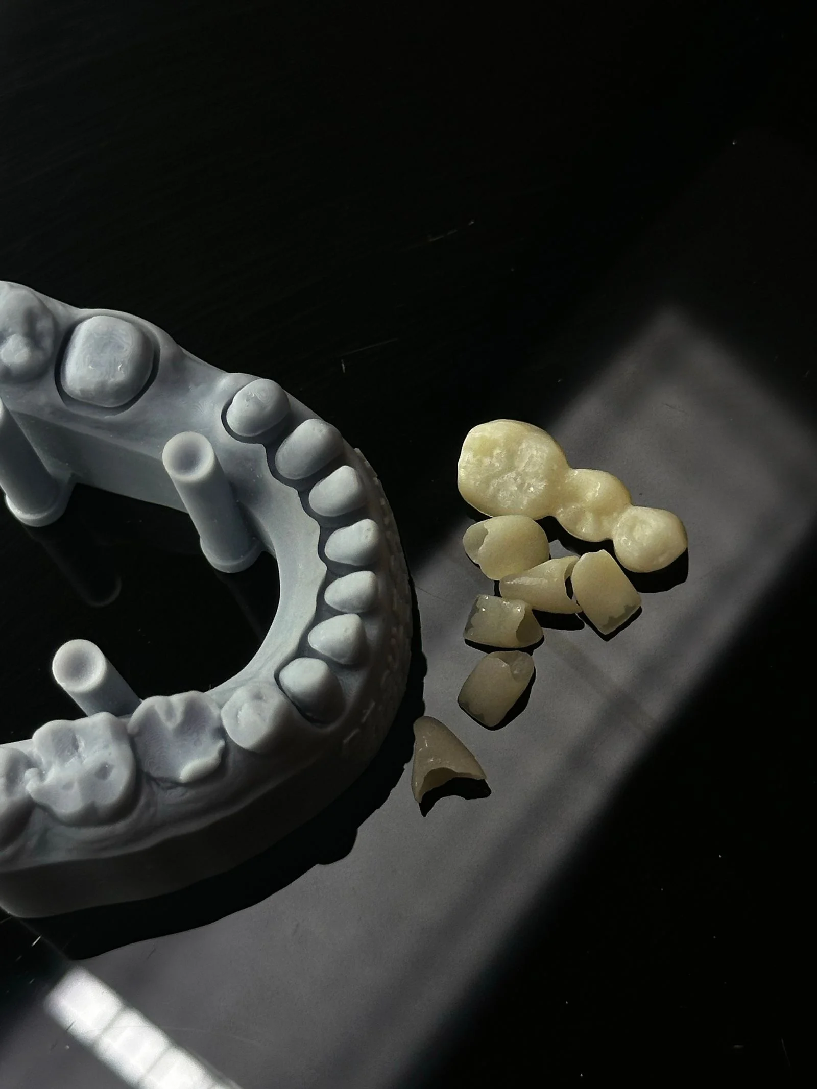 Aynı gün implant uygulamasında kullanılan implant gövdesi ve diş modeli