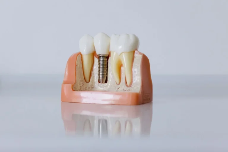 Aynı gün implant kimlere uygulanır sorusunu değerlendiren çene cerrahı