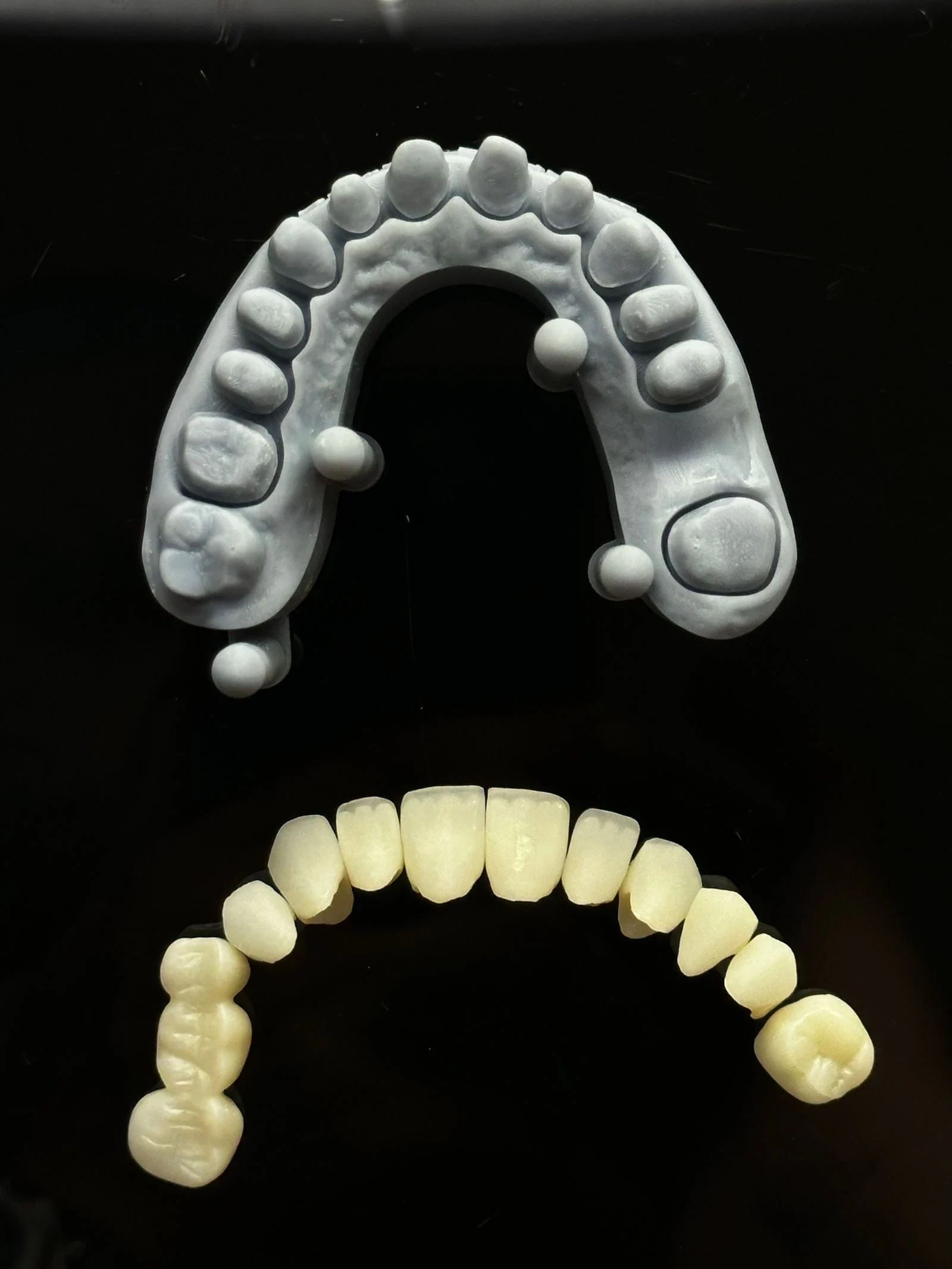Fațete Emax sau ceramice în Turcia comparate pe un model dentar în clinică