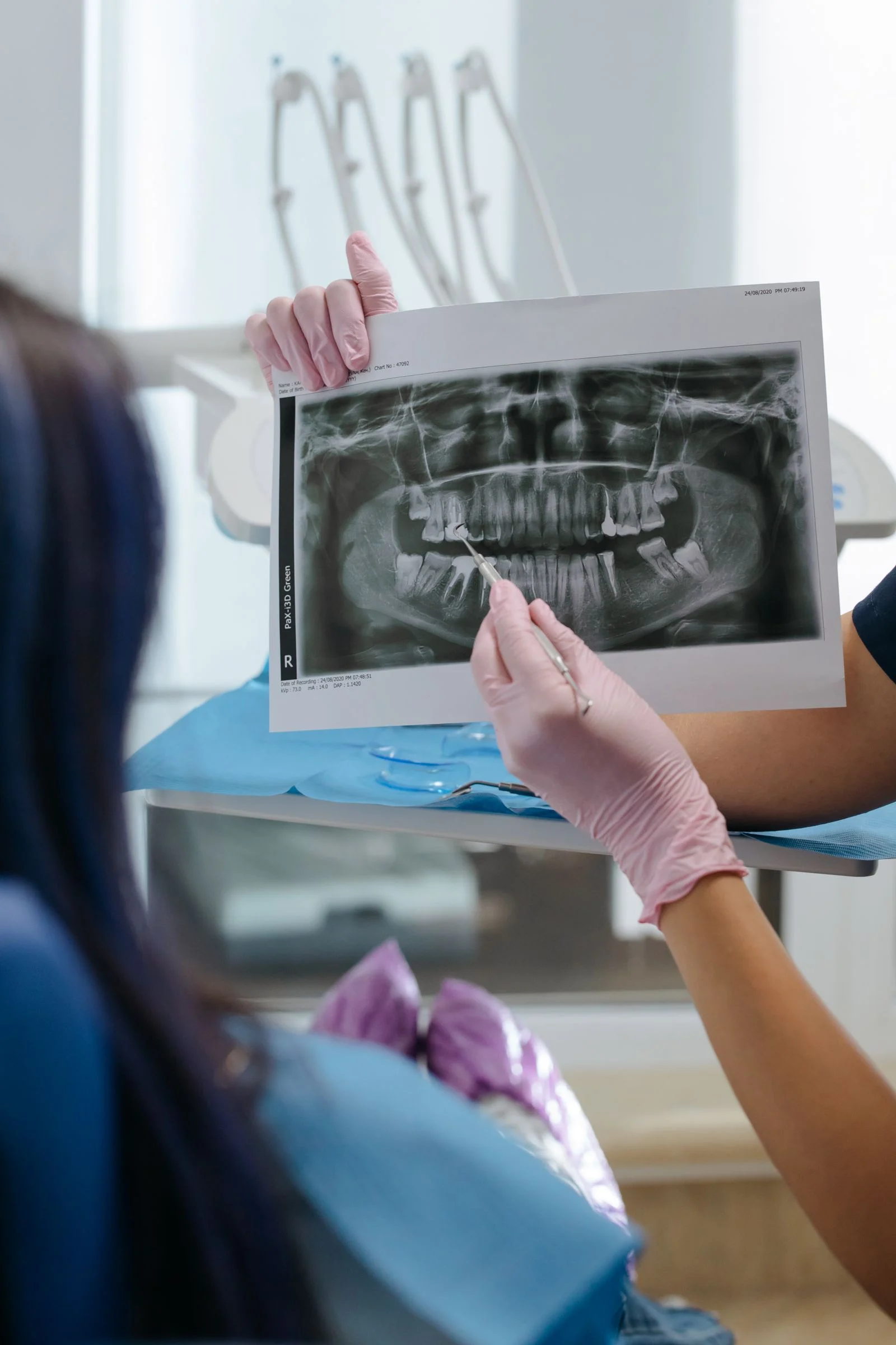 Dentist explaining how successful are dental implants using a patient X-ray