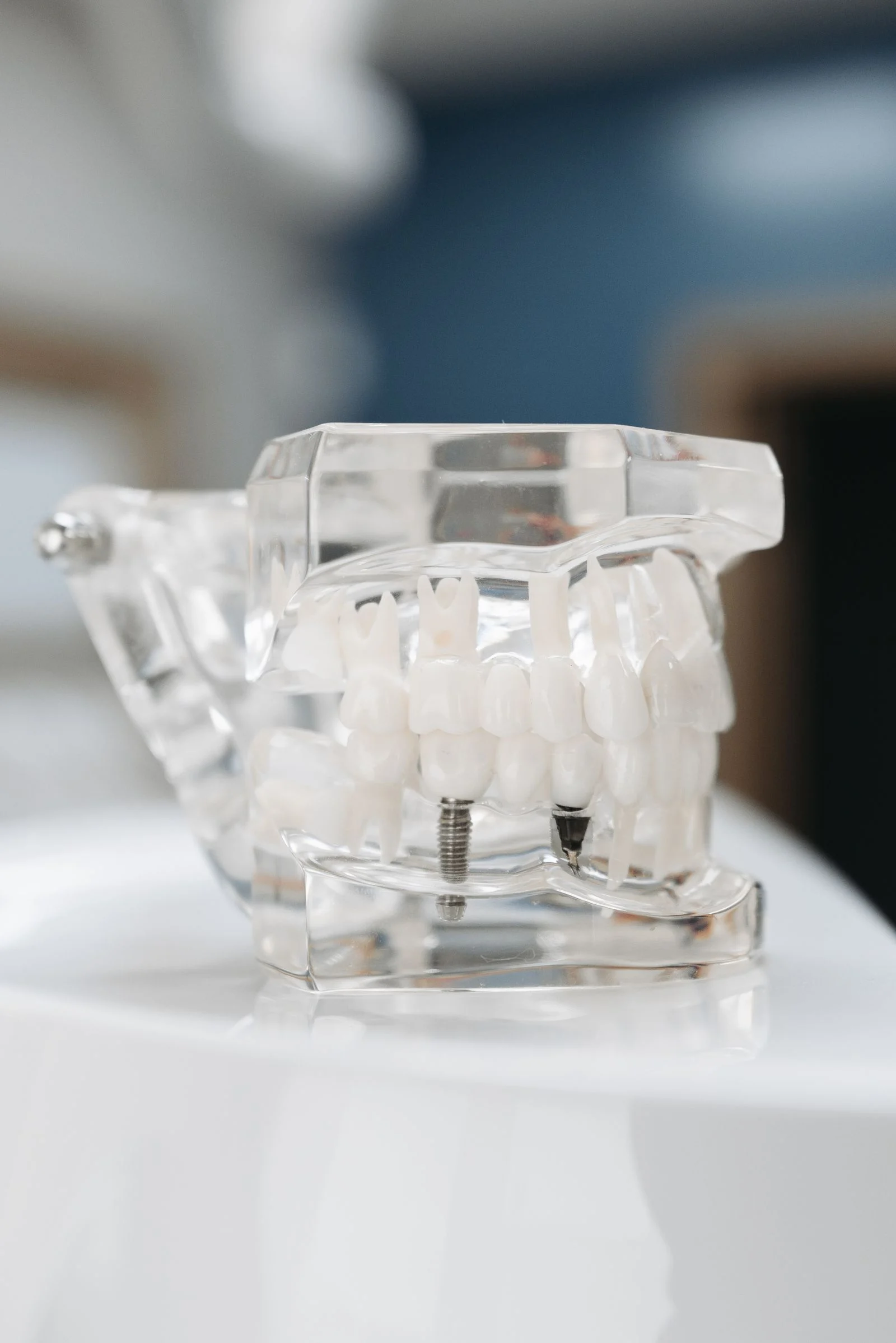 Tüm ağız implant kimlere uygundur sorusunu gösteren şeffaf çene modeli ve implant vidaları