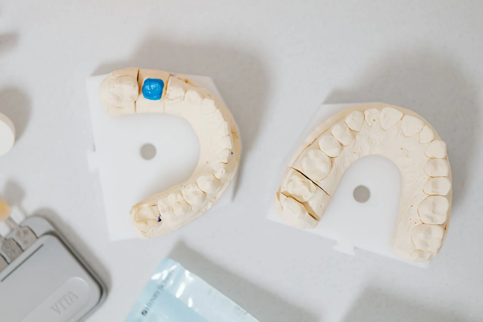 Dental models and components used in a full mouth implant restoration