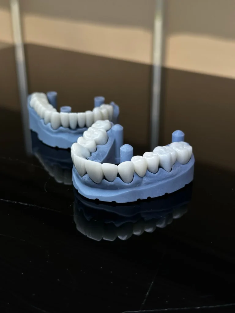 Why choose Emax veneers in Turkey explained with a shade guide in an Istanbul clinic