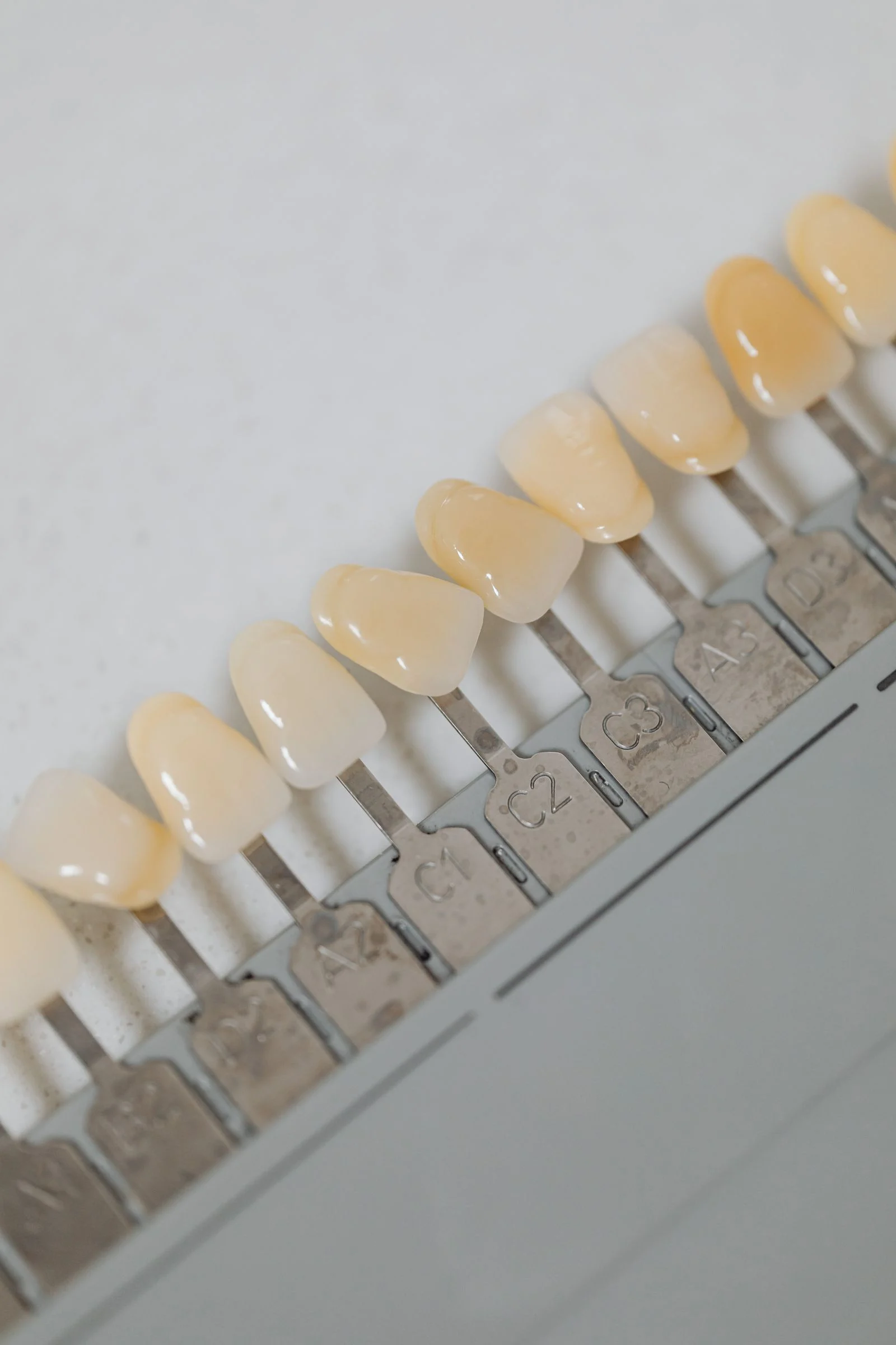 Coroane din zirconiu sau fațete comparate într-o clinică dentară