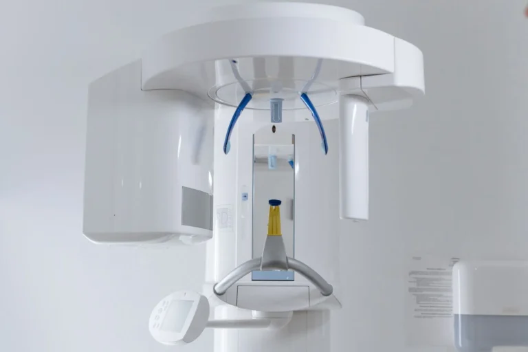 İmplant iyileşme süreci nasıl ilerler sorusunu gösteren implant sonrası kontrol röntgeni