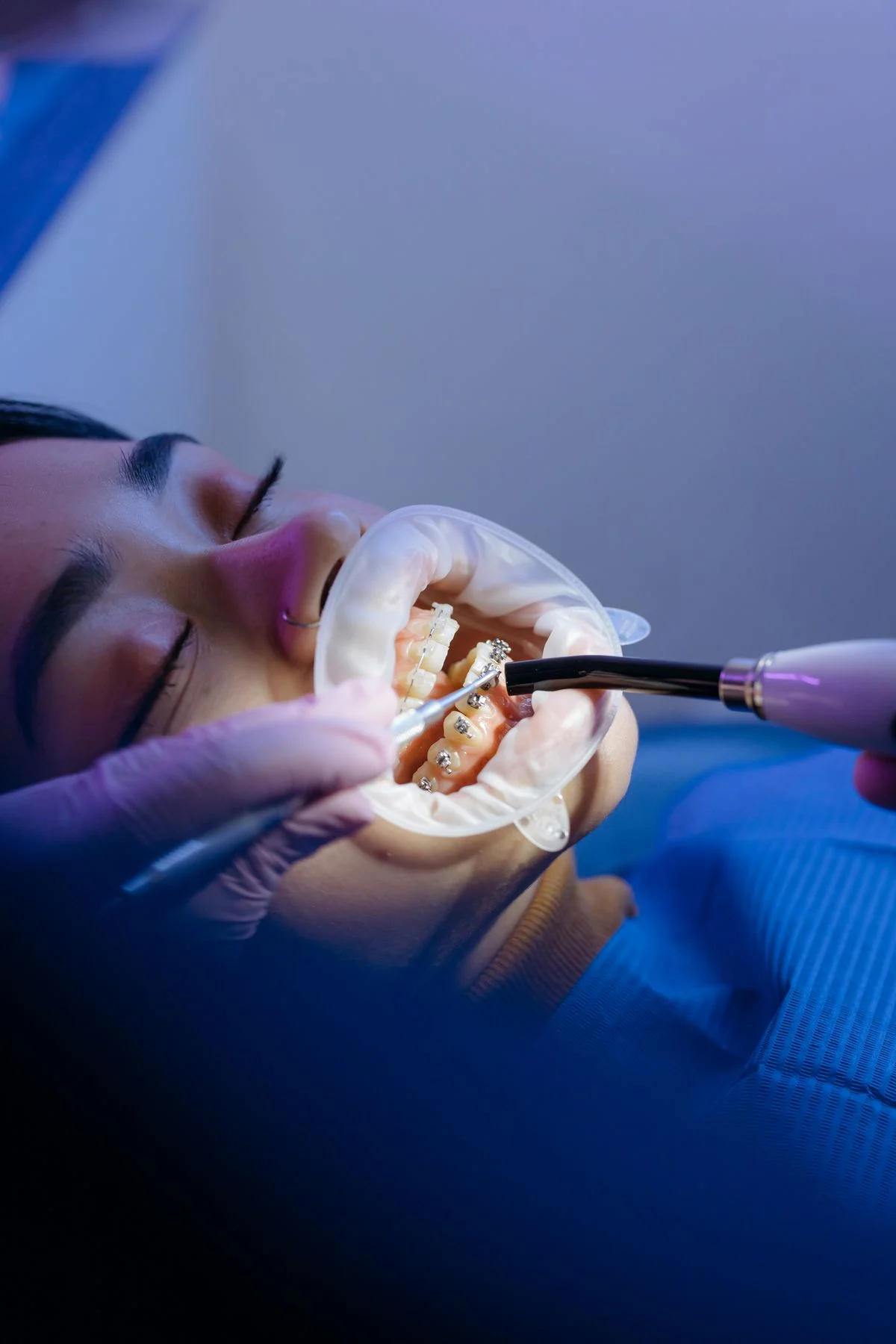 Oral surgeon pointing at bone levels on a panoramic dental X-ray
