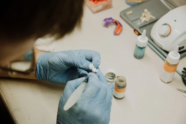 What is teeth in a day shown with a fixed implant bridge prepared in the dental laboratory